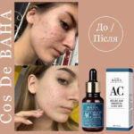 cos de baha azelaic acid hinokitiol clear skin 30ml - Image 4